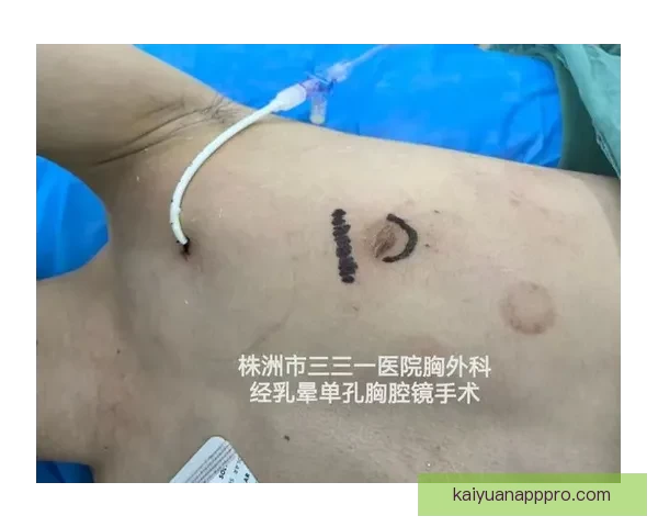 坎宁安气胸康复持续推进 活塞计划一周后复查评估